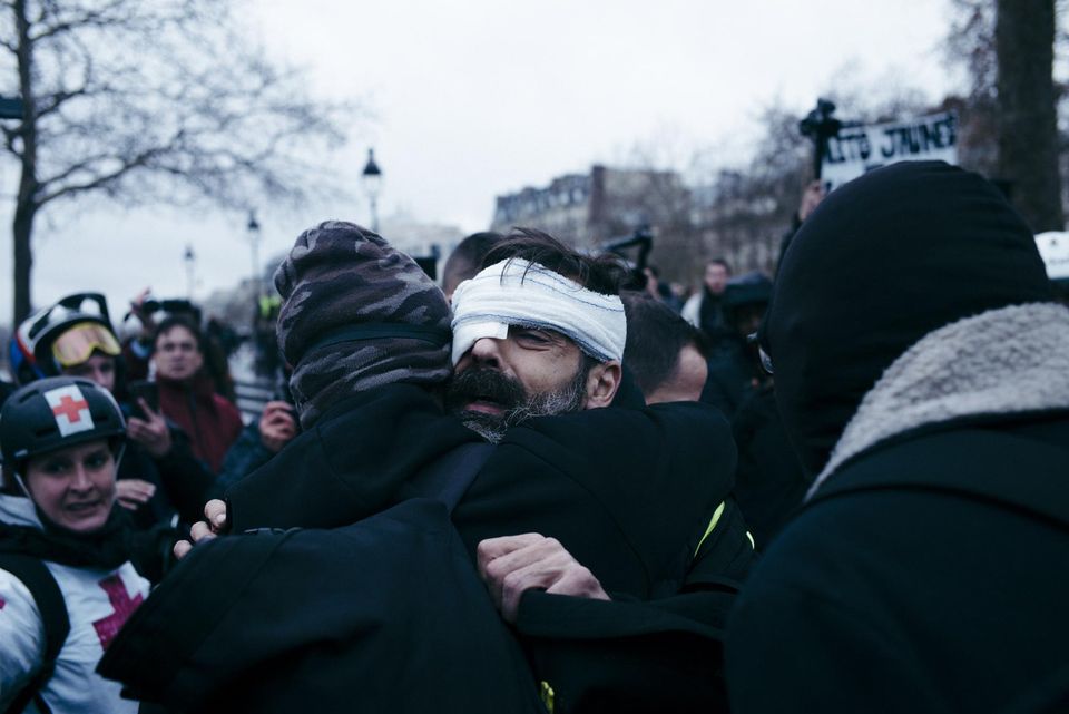 France A La Manifestation Encore Un Gilet Jaune Grièvement